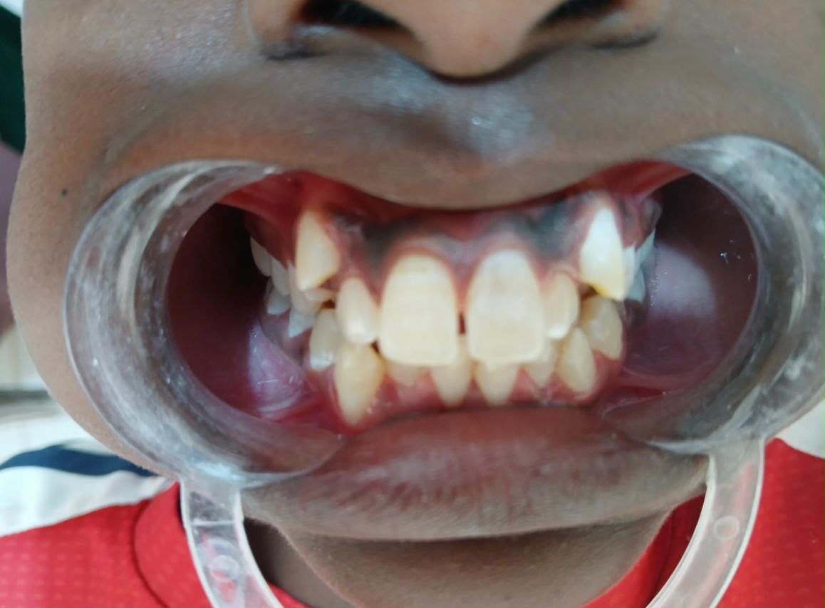 Dentist in Eastliegh