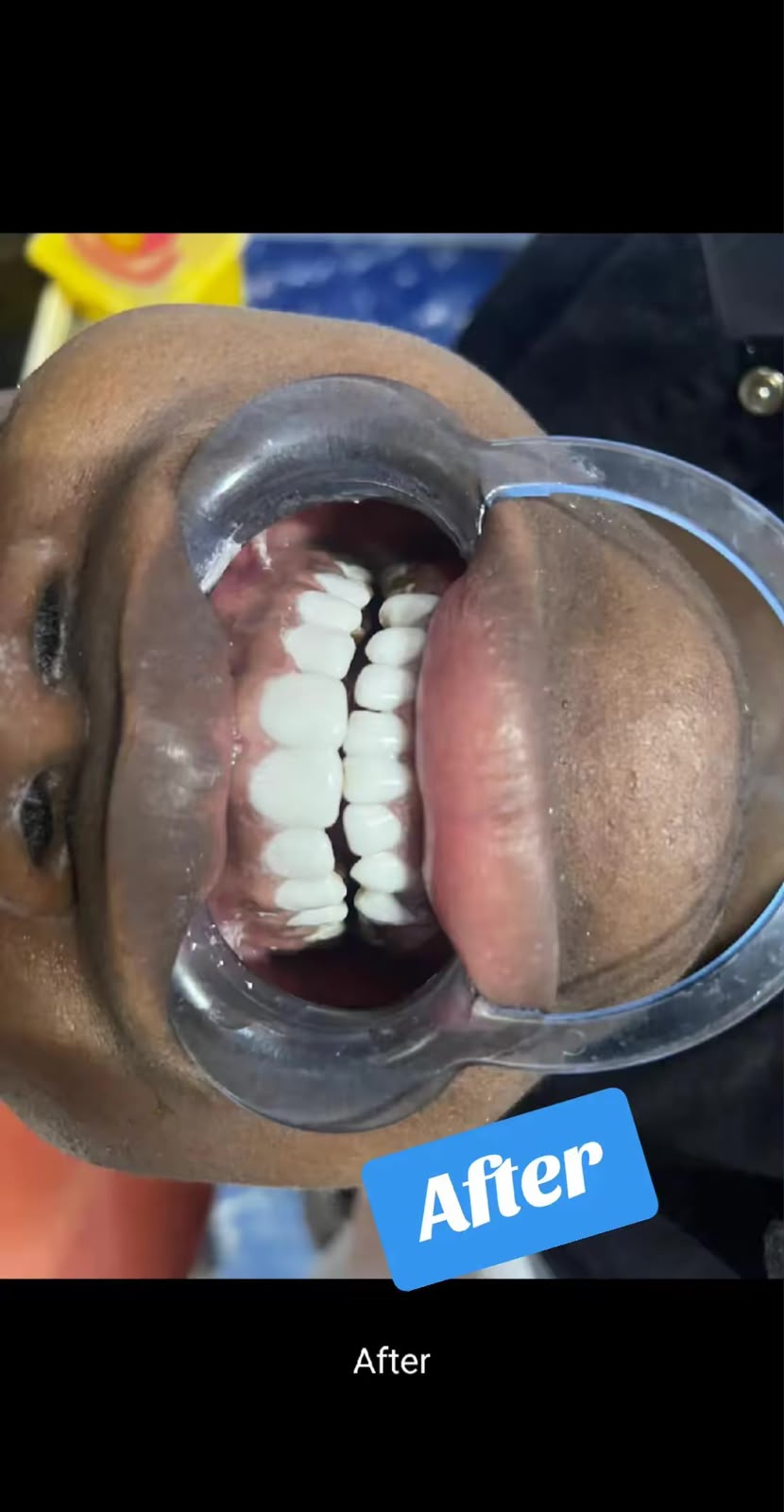 Dentist in Eastliegh