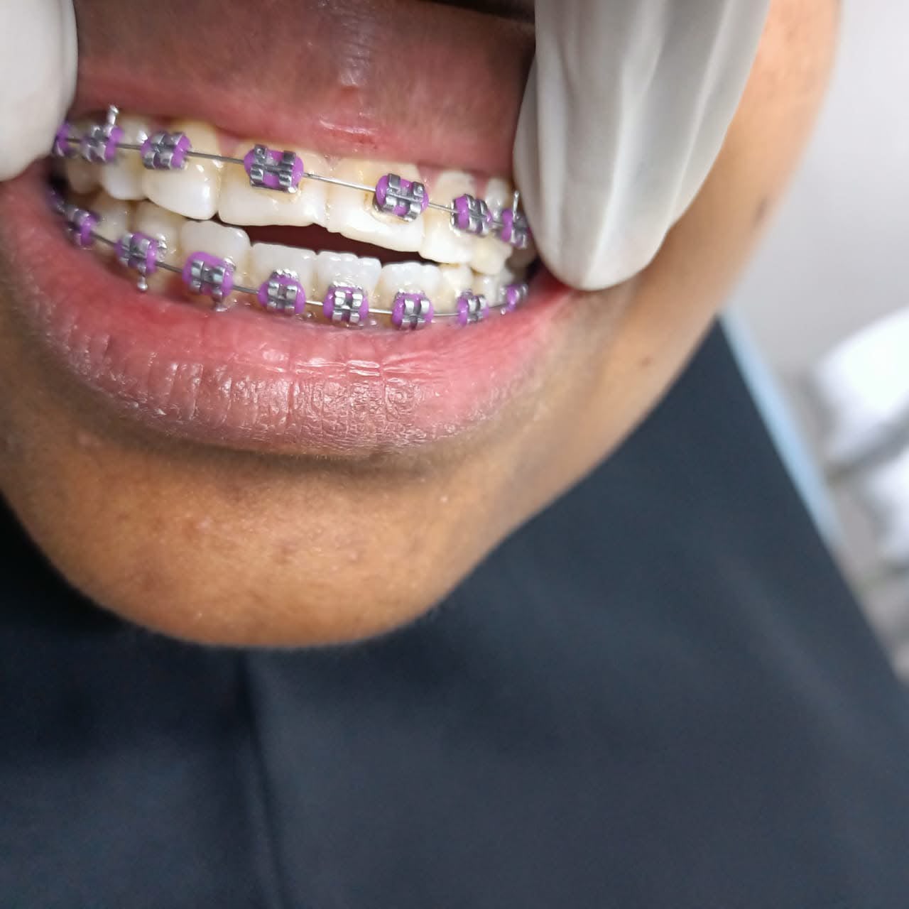 Dentist in Eastliegh